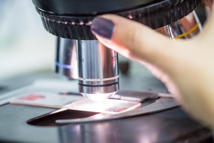 أخذ الخزعات في عيادة “صحتنا” لأمراض الفم والأسنان