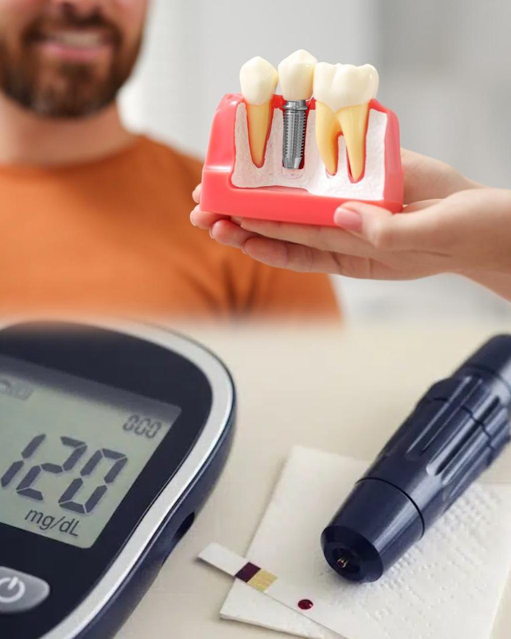 السكر التراكمي وزراعة الأسنان